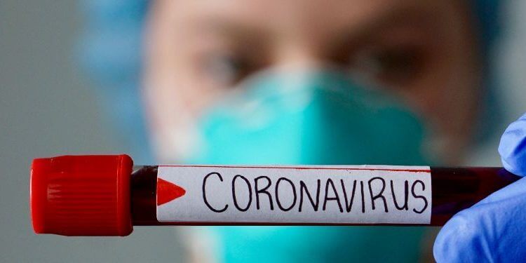 TODO LO QUE DEBES SABER SOBRE EL CORONAVIRUS