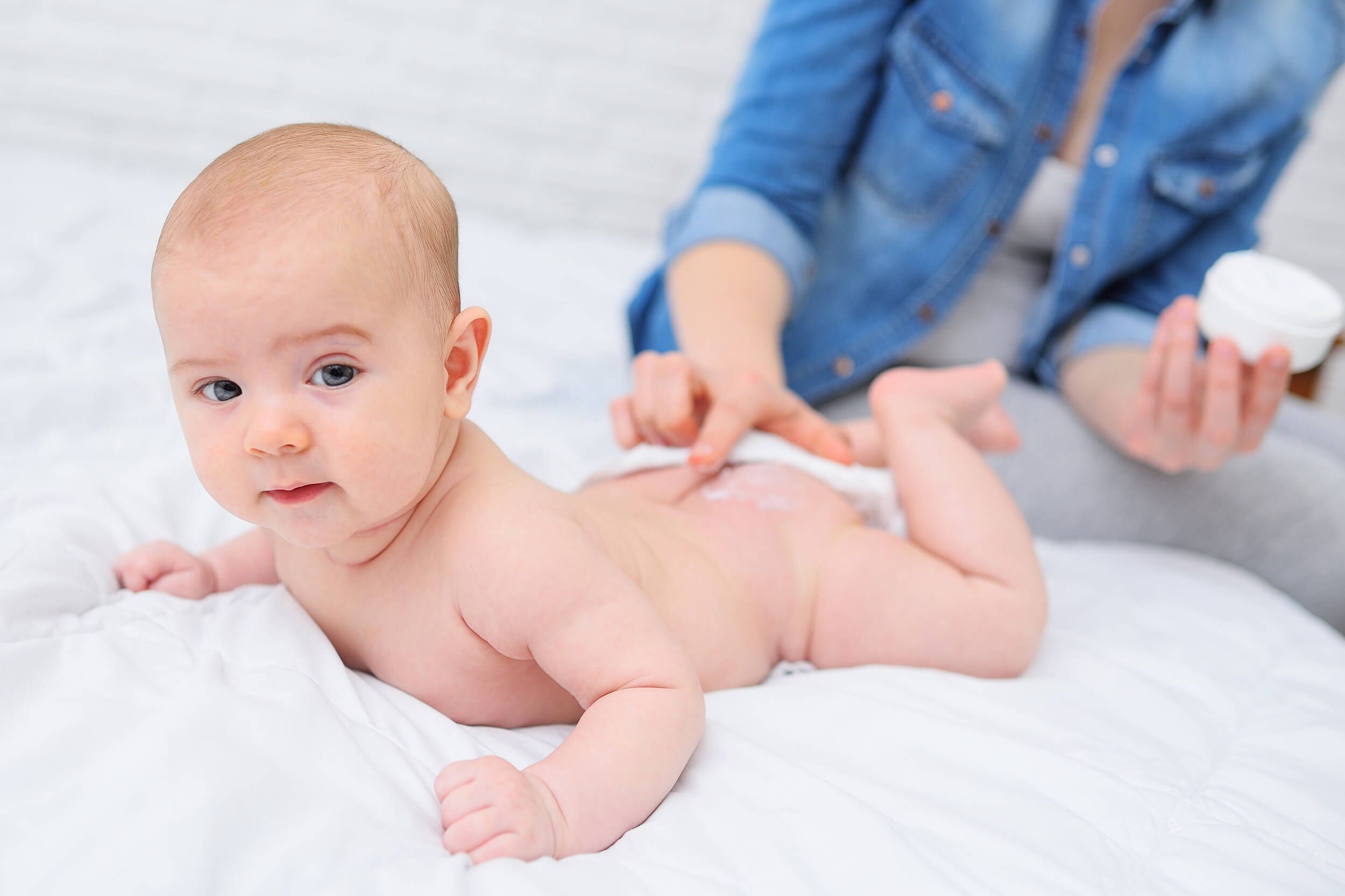 Cómo detectar y tratar la dermatitis atópica en bebés