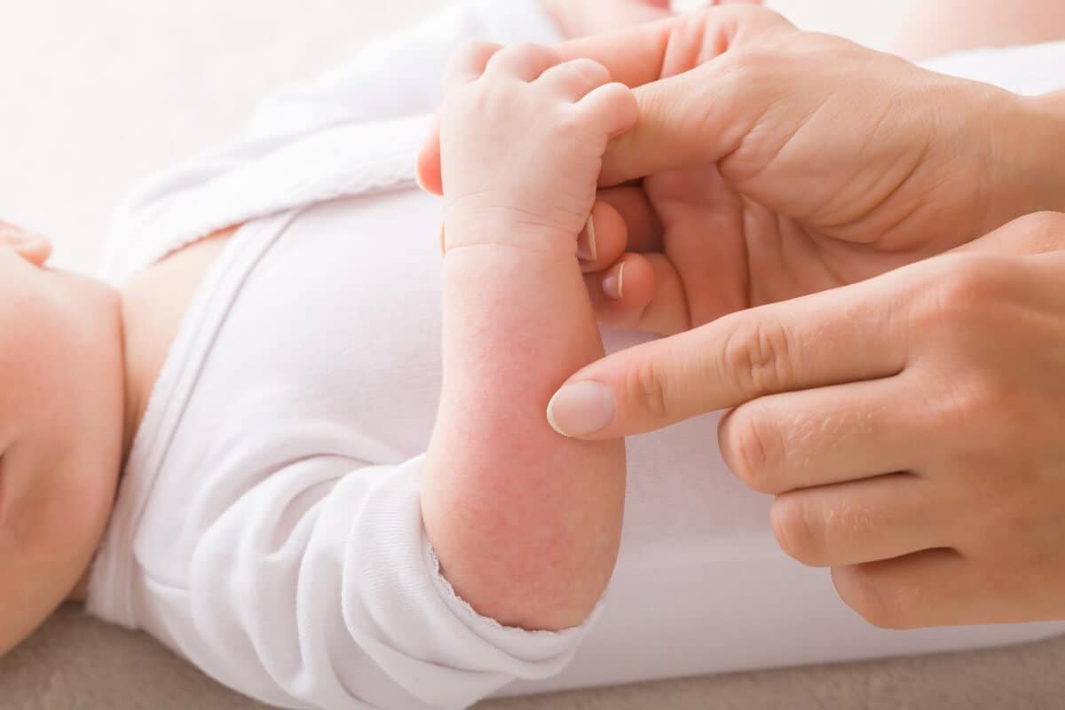 Alergias infantiles en la piel: tipos, causas y tratamientos