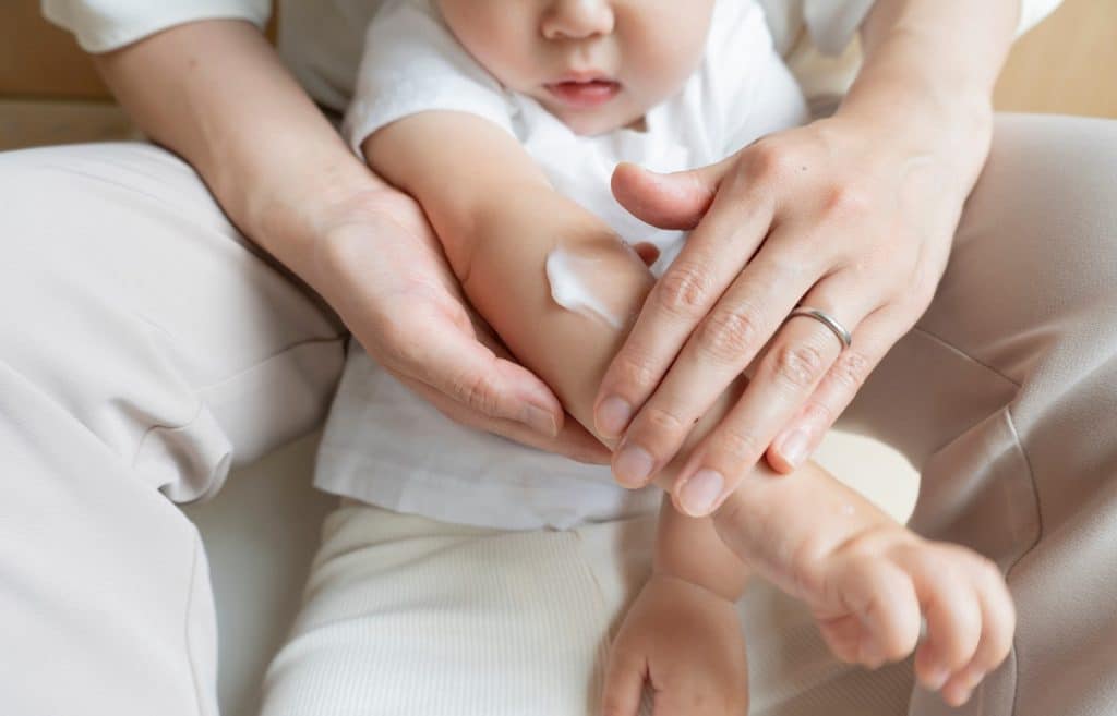 Cómo cuidar la piel atópica en niños: consejos y rutinas